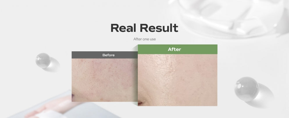SUNGBOON EDITOR Deep Cica Teatree Soothing Mask SUNGBOON EDITOR