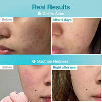 numbuzin No.1 Pantothenic B5 Hyaluronic Active Clear Mask numbuzin