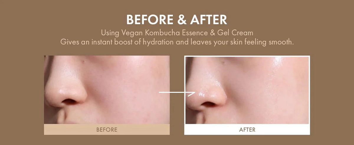 Dr.Ceuracle VEGAN KOMBUCHA TEA GEL CREAM Dr.Ceuracle