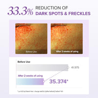mary&may tranexamic acid + glutathione eye cream MARY&MAY