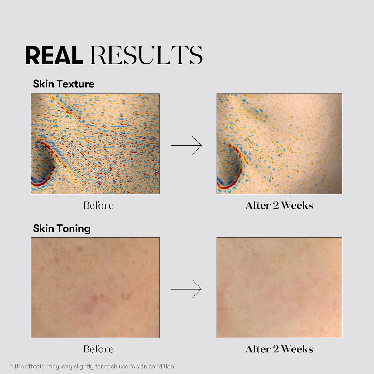 VT COSMETICS TX-TONING ESSENCE 2000 SHOT VT COSMETICS