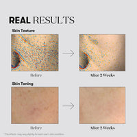 VT COSMETICS TX-TONING DAILY MASK VT COSMETICS
