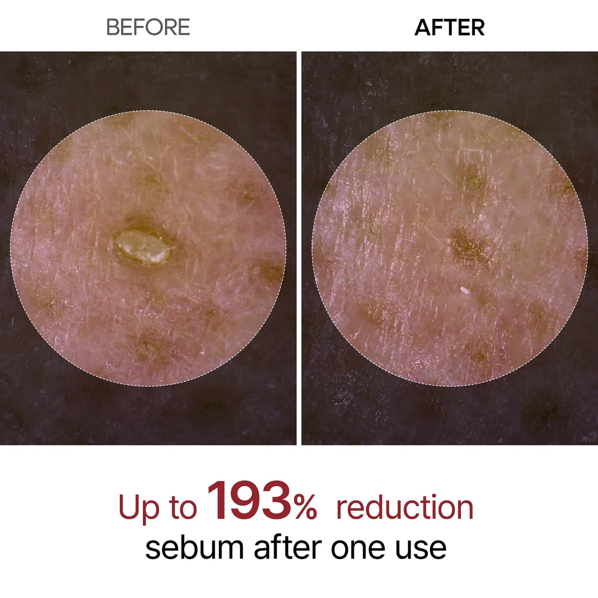 Dr.Melaxin Peel Shot Exfoliating Black Rice Ampoule