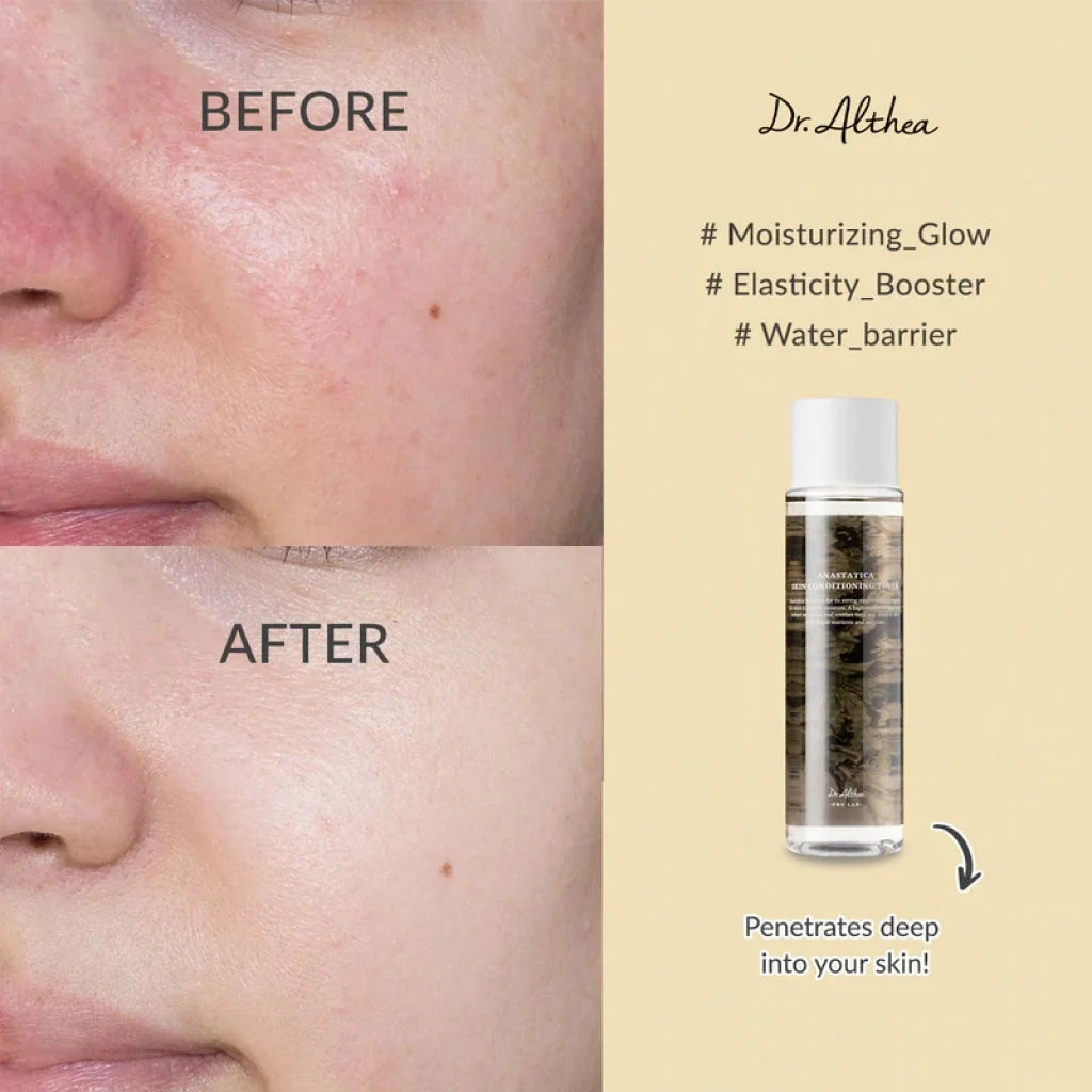 Dr.Althea Anastatica Skin Conditioning Toner Dr.Althea