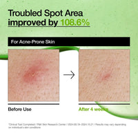 Anua Azelaic Acid 10 Hyaluron Redness Soothing Serum Anua