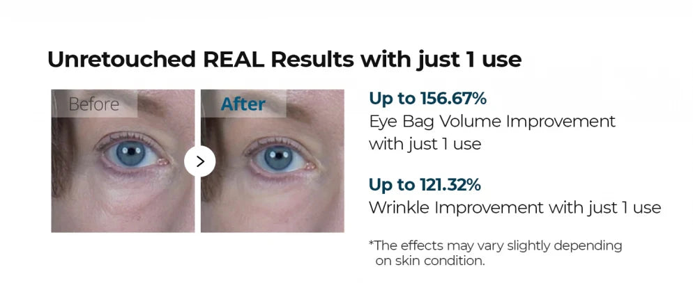 Dr.Melaxin Eyephalt Eyebag Cream