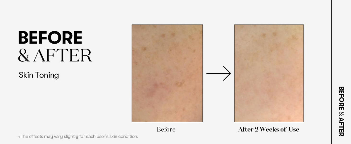 VT COSMETICS TX-TONING ESSENCE 1000 SHOT VT COSMETICS