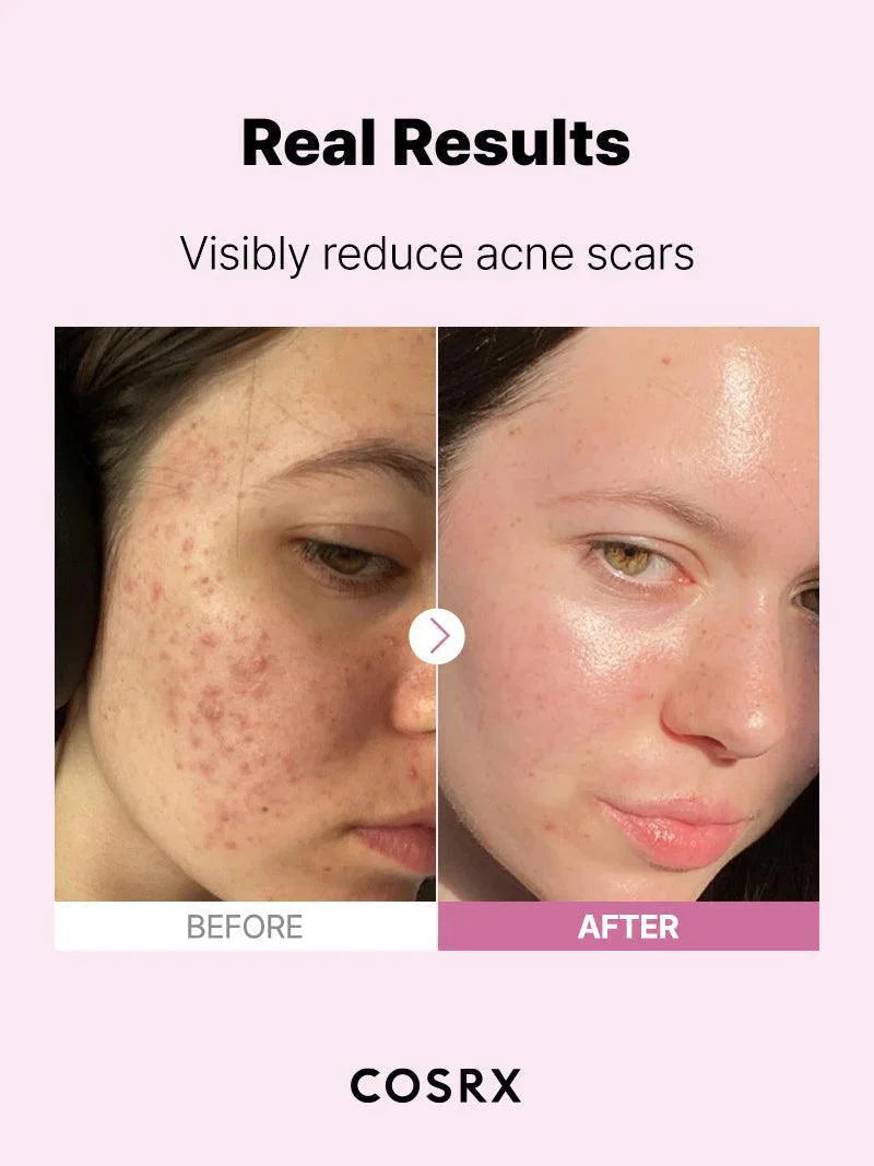 COSRX The Niacinamide 15 Serum COSRX